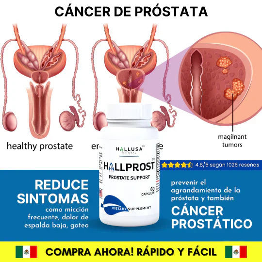 HALLPROST Tratamiento Completo-TOP DE VENTAS